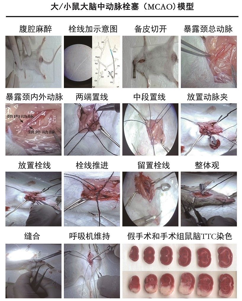 大 / 小鼠大腦中動(dòng)脈栓塞 (MCAO) 模型